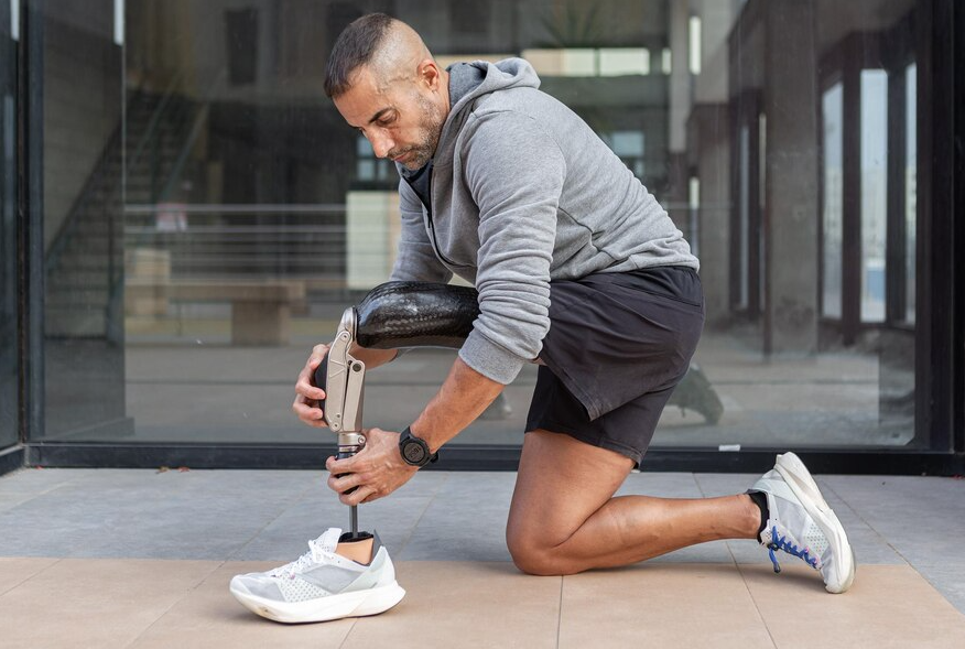 Prosthetic Limb Fitting